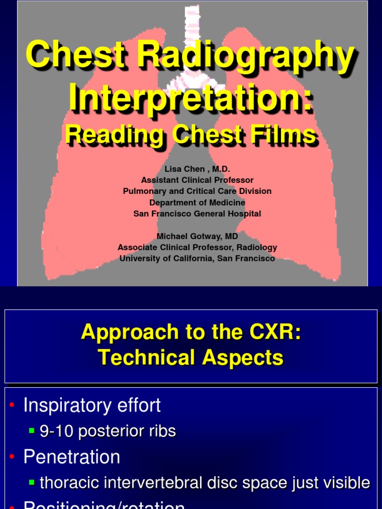 Chest Radiography Interpretation Guide | PDF | Lung | Thorax