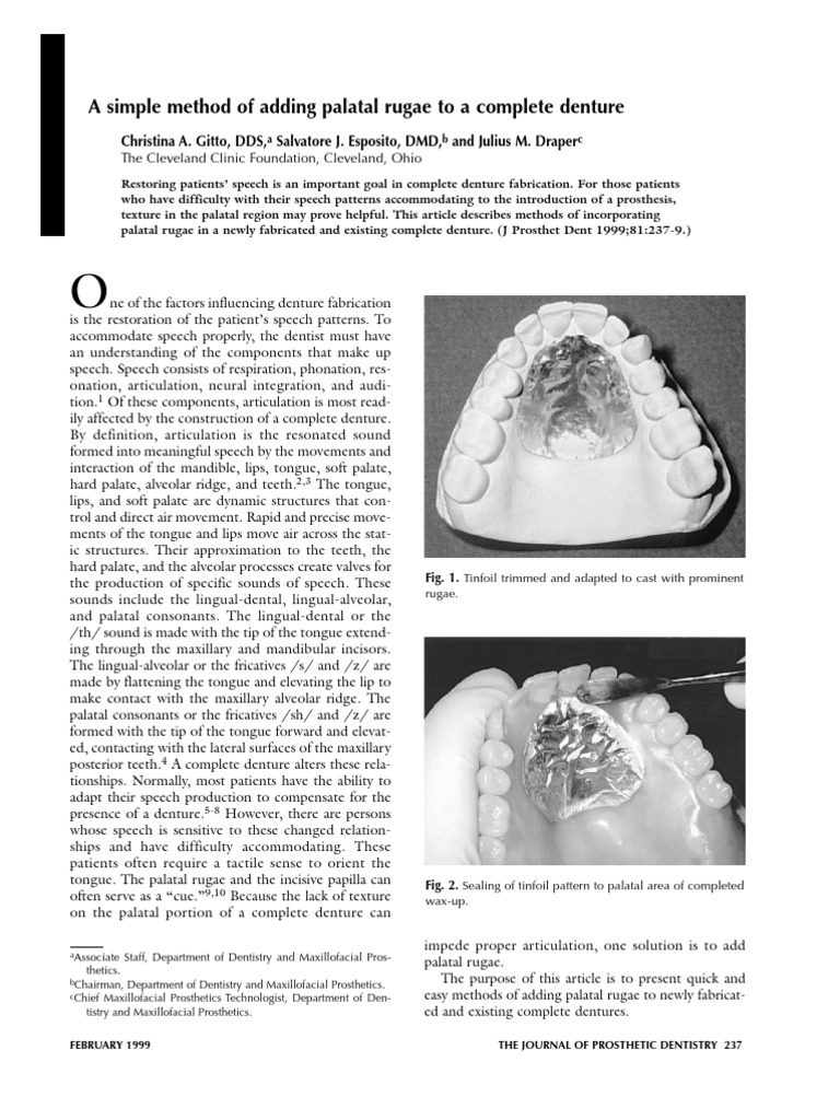 A Simple Method of Adding Palatal Rugae to a Complete Denture