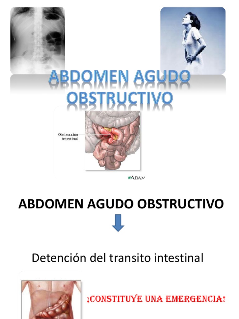 Abdomen Agudo Obstructivo
