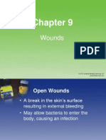 CH09 Wounds