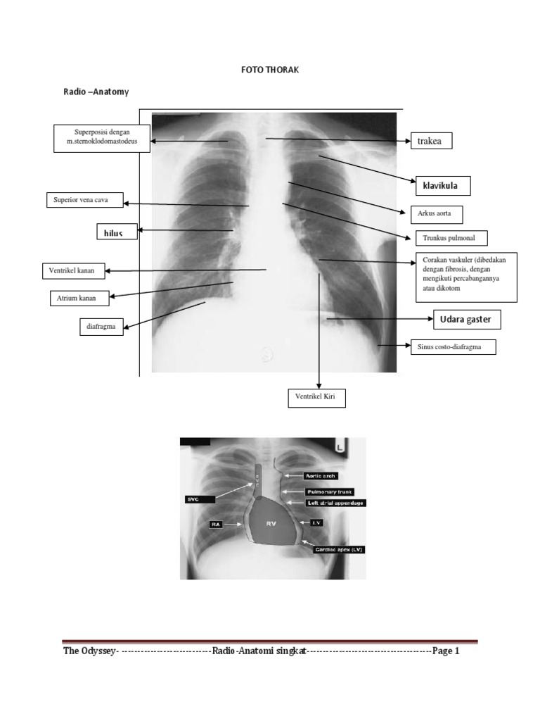 Panduan Foto Radiologi Anatomi Thorak | PDF | Sejarah