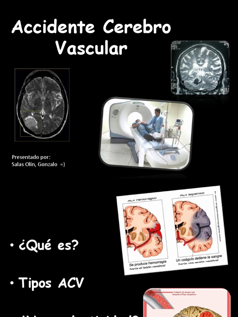 ACV | PDF | Estilo de vida