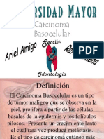 Carcinoma Ba So Celular