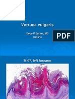 Verruca Vulgaris. M 67, Left Forearm. PPT