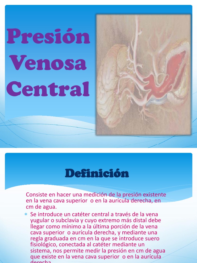 Presión venosa central PVC Vena Volumen