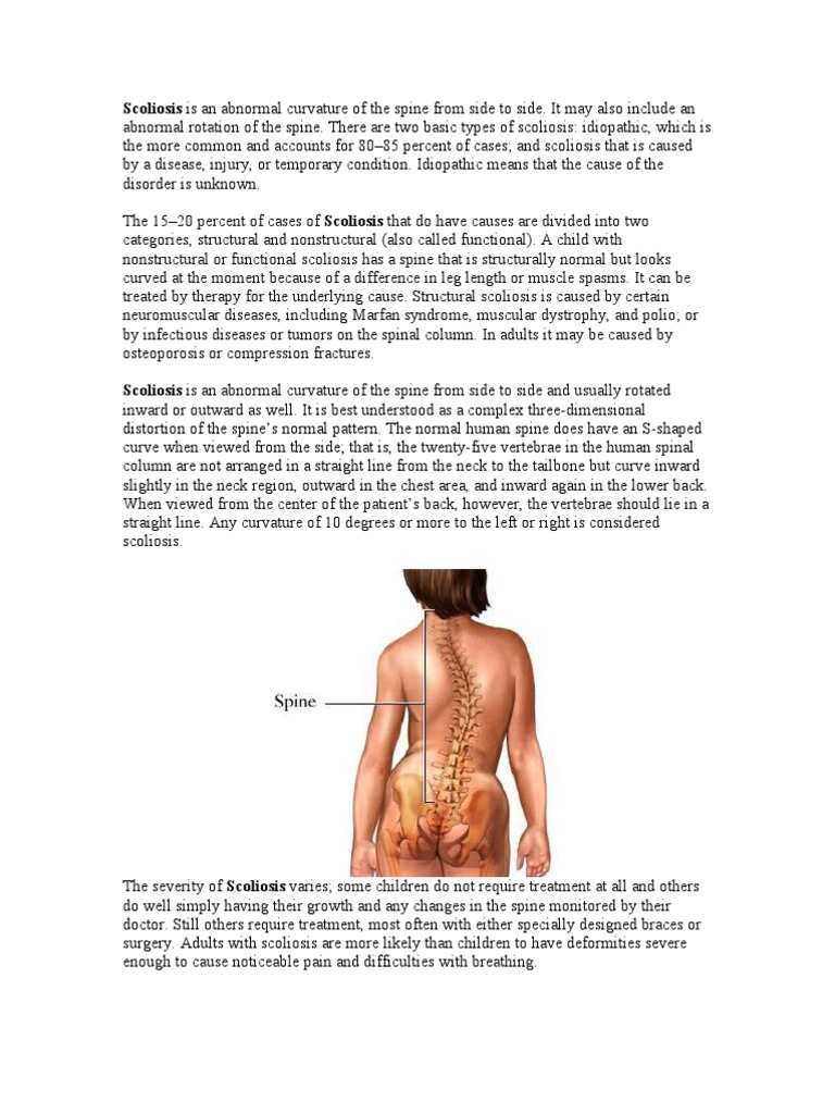 Nursing Considerations for Spine Curvature Disorders