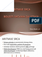 Aritmije Srca