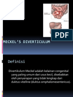 Meckel’s Diverticulum