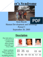 Turner's Syndrome: Kim Huynh Human Development and Sociology Period 3 September 26, 2005