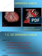 Ponencia Grandes Vasos