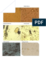 Examen microscópico de Orina