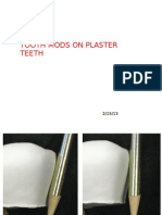 Plaster Tooth Mods