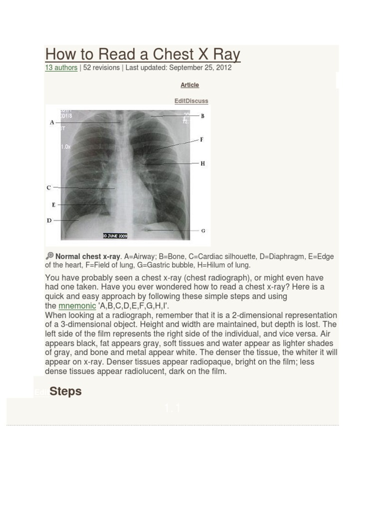 How to Read a Chest X Ray Lung Human Anatomy