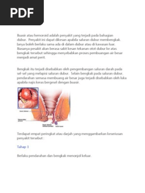 Buasir Pdf
