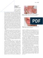 Neonatal Chronic Bullous Disease and Pneumonia