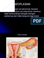 Neoplasm A