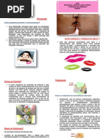 Mononucleose Infecsiosa