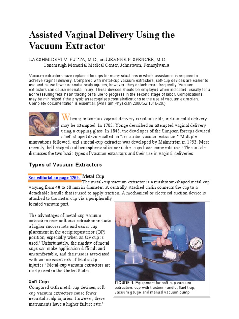 Assisted Vaginal Delivery Using the Vacuum Extractor Childbirth