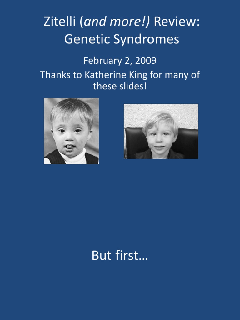 Genetic Syndromes Overview and Analysis | PDF | Congenital Disorder ...