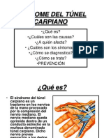 Síndrome del túnel carpiano: causas, síntomas y tratamiento