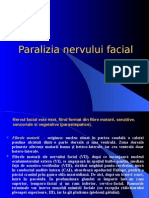 Paralizia Nervului Facial