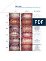 Treated Orthodontics Cases
