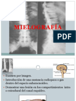 Mielografia