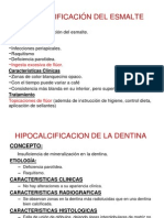 Hipocalcificacion Del Esmalte