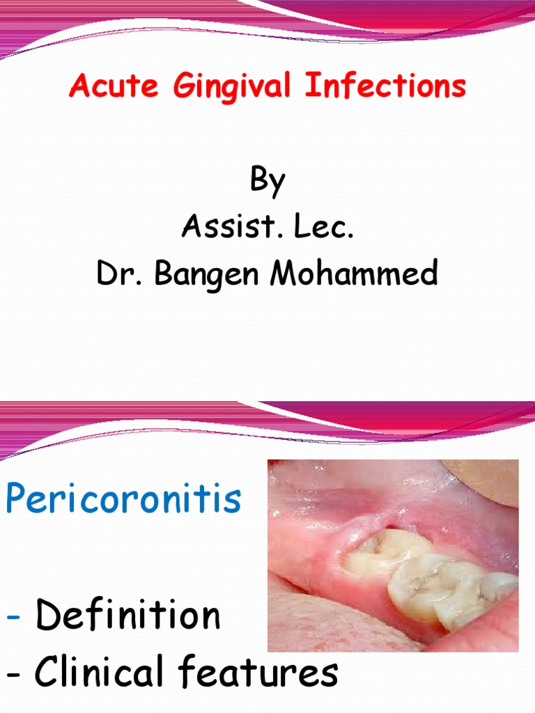 4th L-4, Acute G. Infection | PDF | Mouth | Medicine