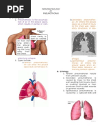 Download Pathophysiology of Pneumothorax by oxidalaj SN12694731 doc pdf