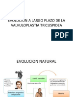 Evolucion a Largo Plazo de La Valvuloplastia Tricuspidea