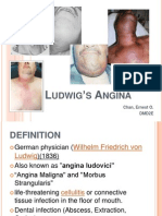 Ludwig's Angina