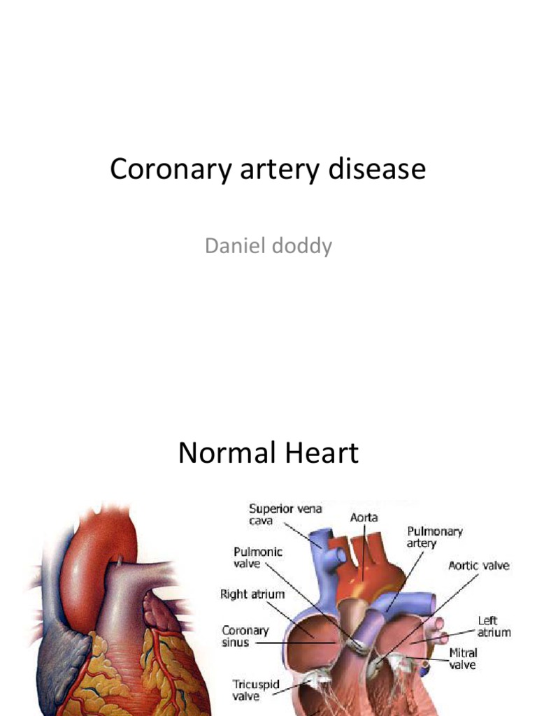 Coronary Artery Disease | PDF | Coronary Artery Disease | Myocardial ...