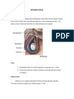 Hydrocele Refrat