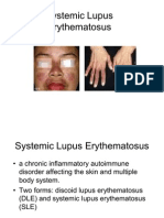 Systemic Lupus Erythematosus