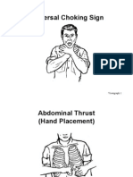 Universal Choking Sign: Viewgraph 1