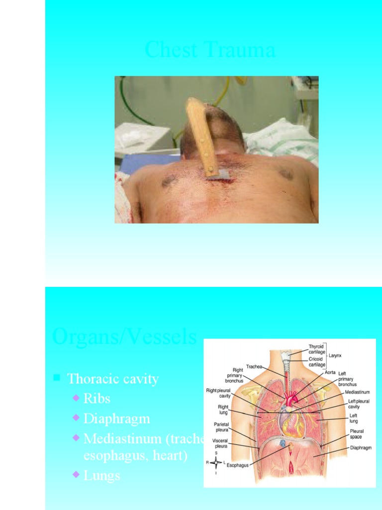 EMT Guide to Chest Trauma Management | PDF | Thorax | Lung
