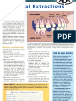 Dental Extractions