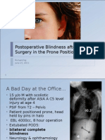 Postoperative Blindness After Spine Surgery in The Prone Position