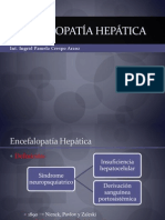 Encefalopatía hepatica