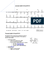 A Normal Adult 12-Lead ECG: Sinus Bradycardia Sinus Tachycardia QRS Axis