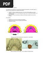 Corona Ansa y Banda Ansa | PDF | Odontología | Diente