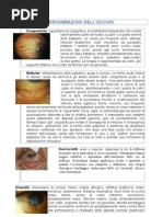 Ricerca: Le Malattie Dell'occhio