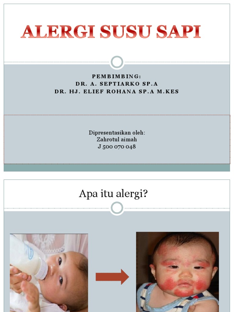 PPT, Penyuluhan ALERGI SUSU SAPI | PDF