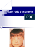 Nephrotic Syndrome