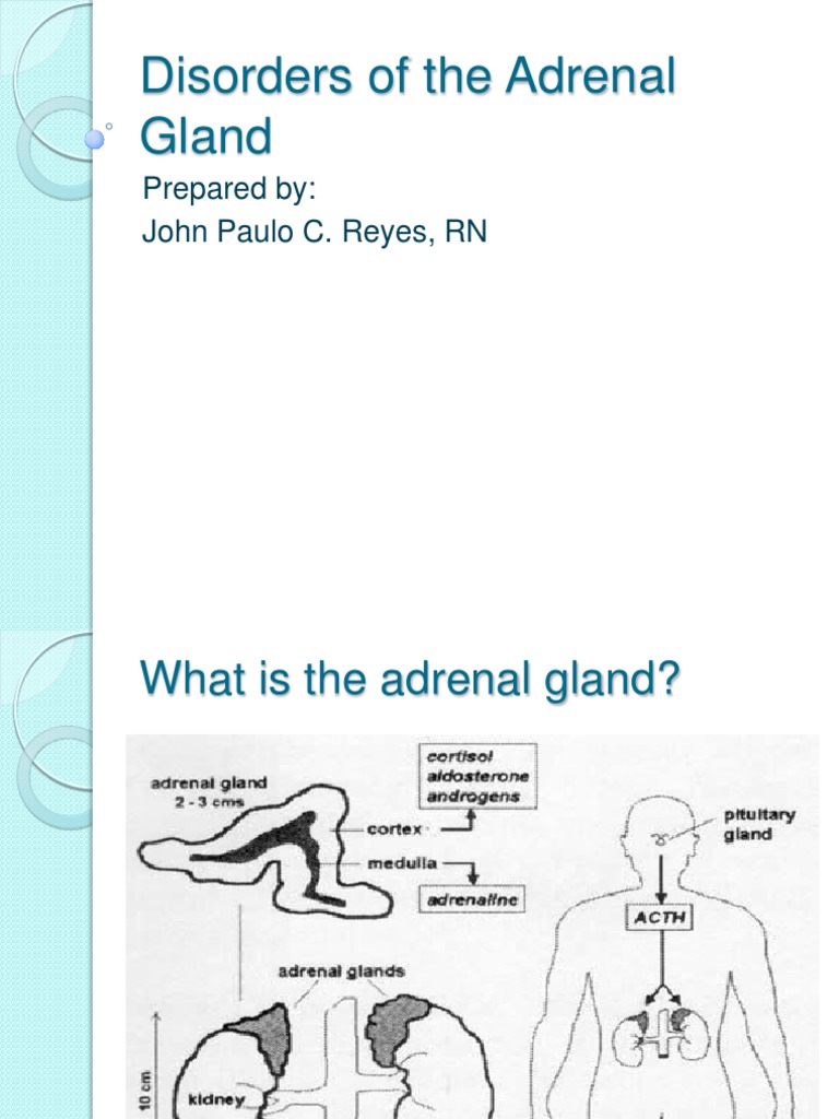 Disorders of the Adrenal Gland Lecture Adrenal Gland Clinical Medicine