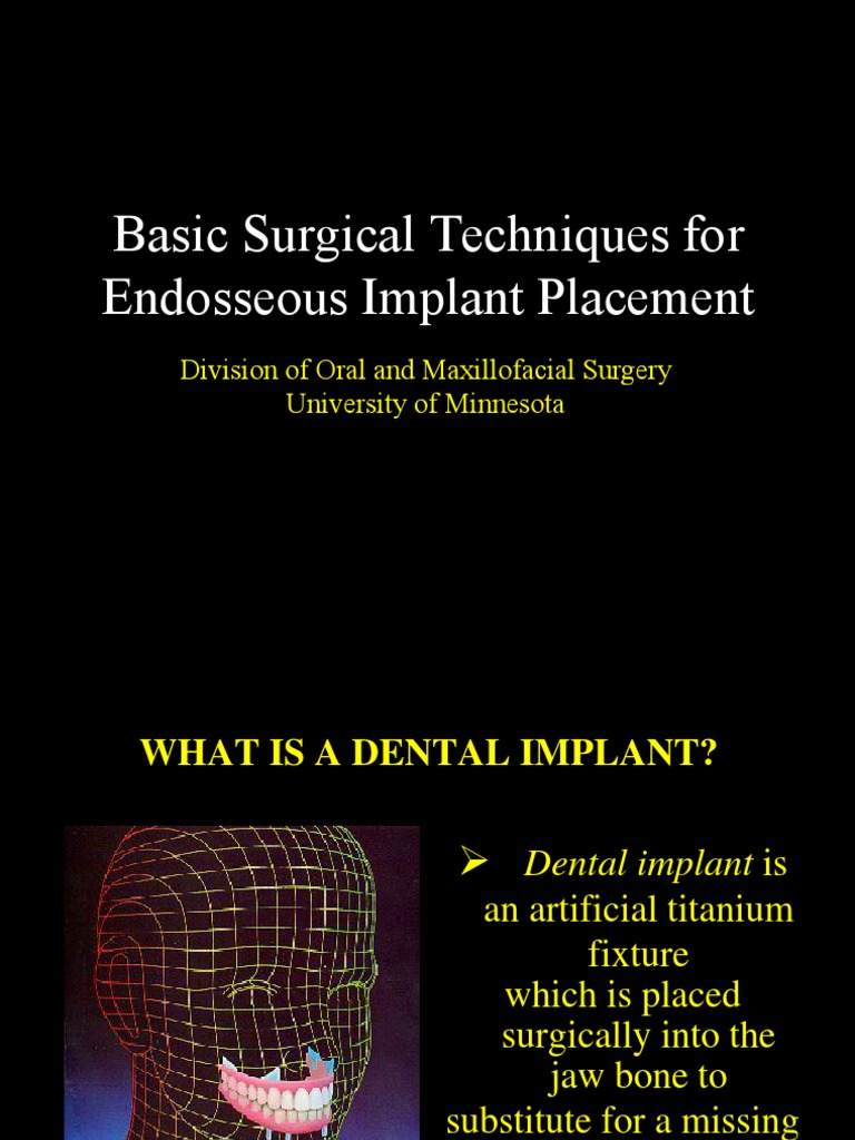 Basic Techniques for Dental Implant Surgery | PDF | Dental Implant | Mouth