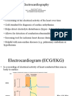 Ecg