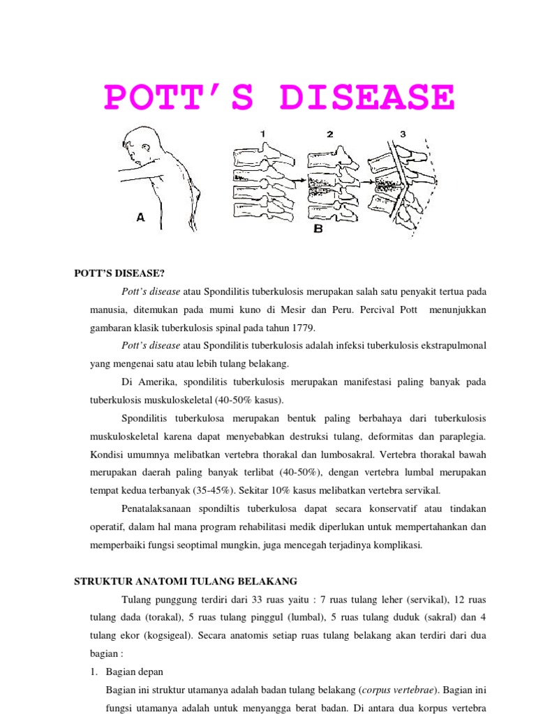 Pott's Disease: Spondilitis Tuberkulosis | PDF | Sains & Matematika