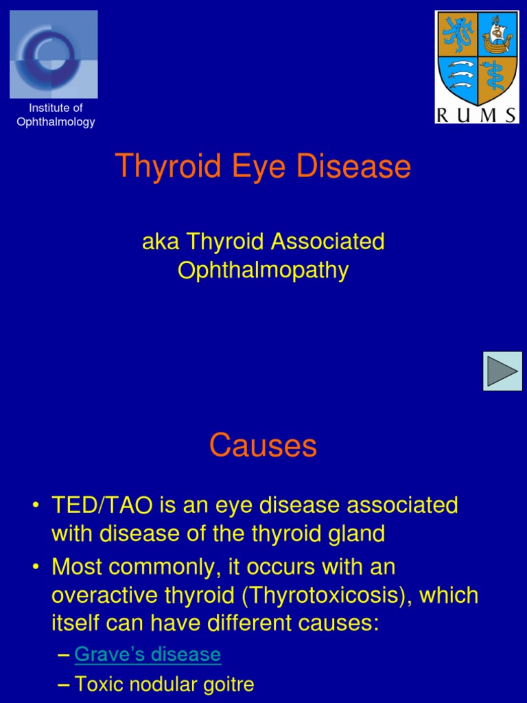 Thyroid Eye Disease: Aka Thyroid Associated Ophthalmopathy | PDF ...
